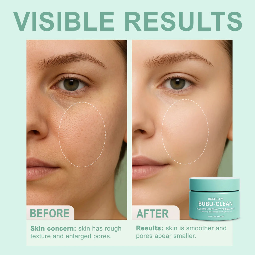 Basil Carbonated Bubble Mask