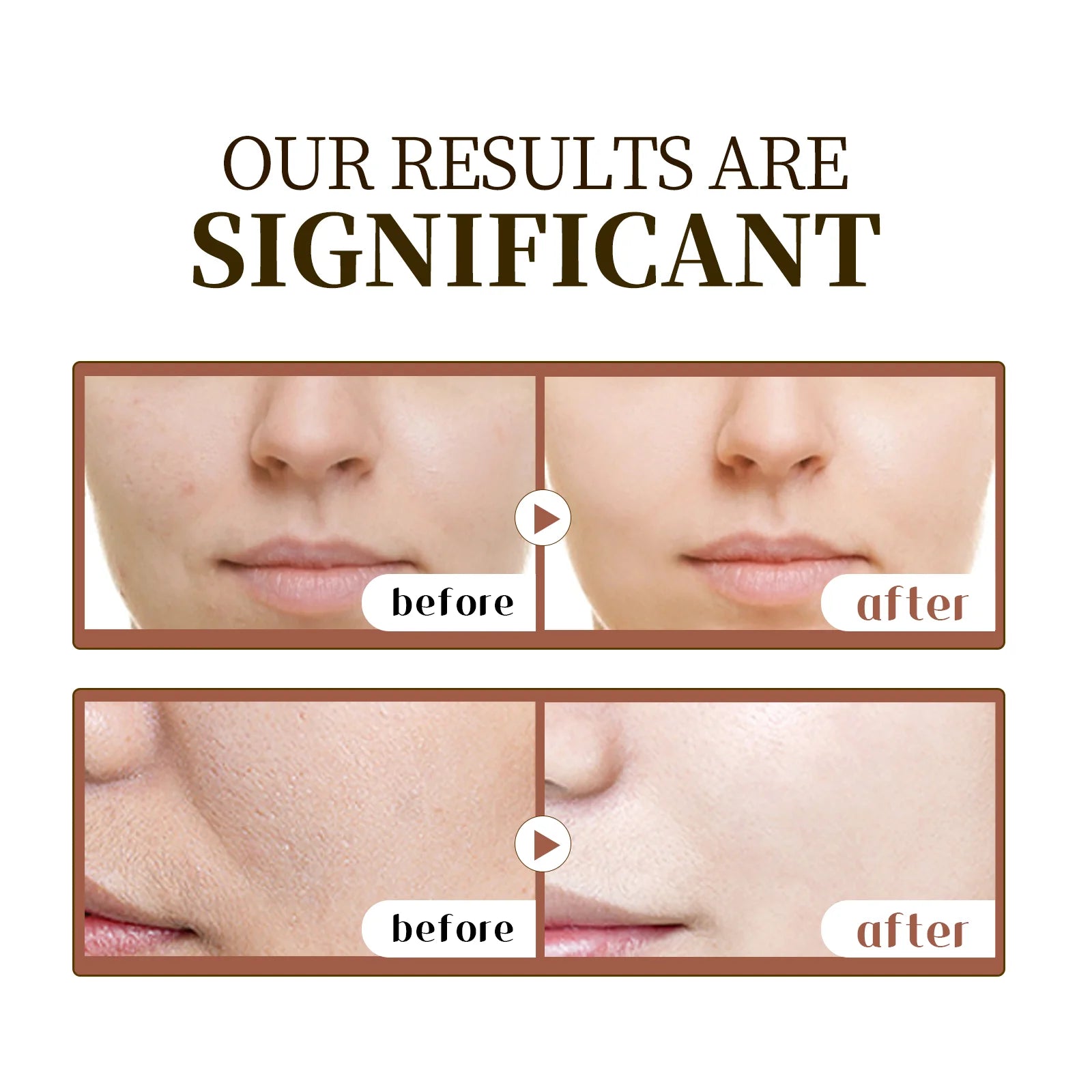 Centella Calm Repair Serum