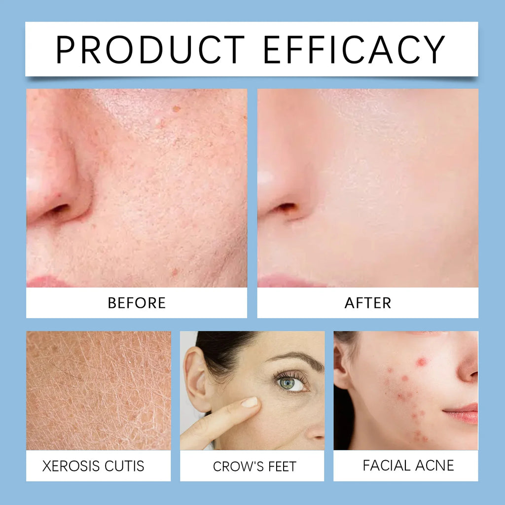 LumiClear™ Pore Reset Pads