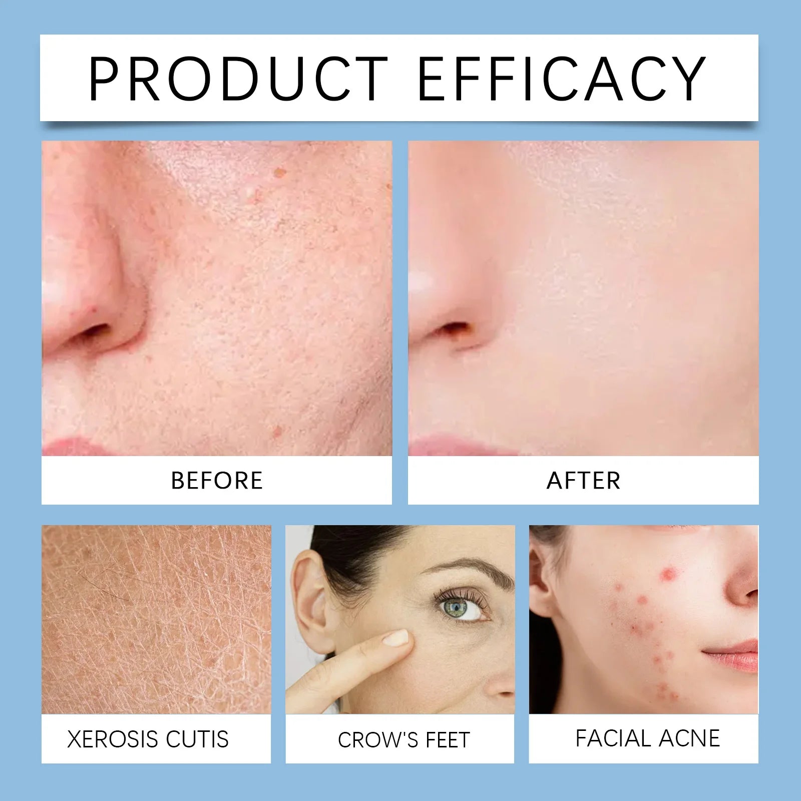 LumiClear™ Pore Reset Pads